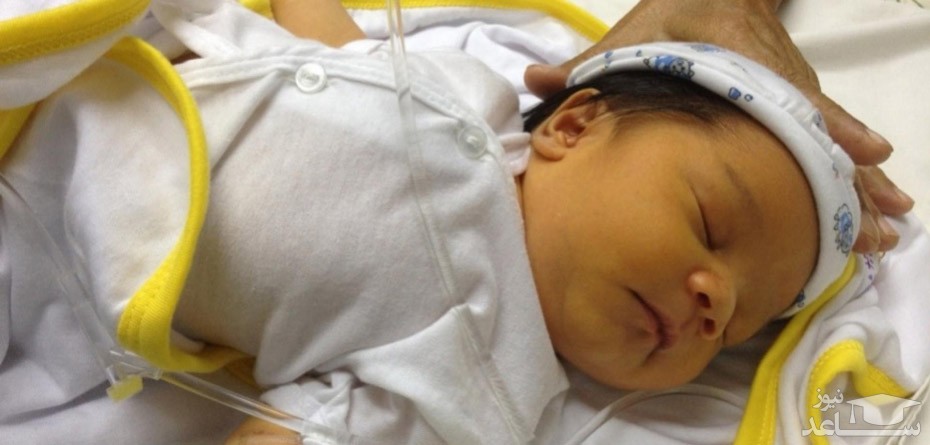 زردی نوزاد چگونه درمان میشود؟