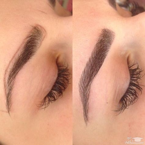 میکروبلیدینگ ابرو