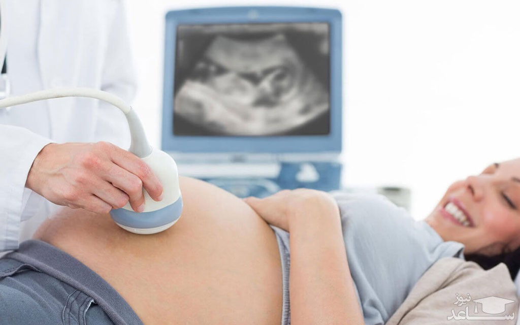 سونوگرافی در دوران بارداری