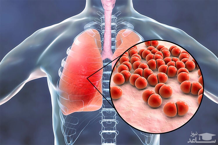 موارد منع مصرف و تداخل دارویی سفتریاکسون