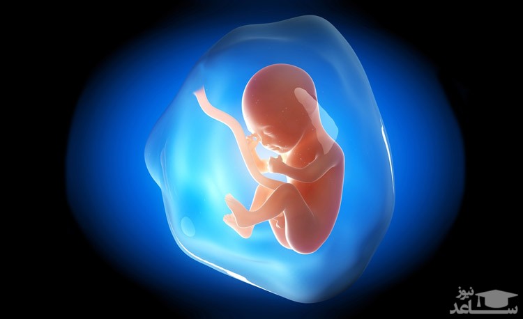 دلایل افزایش و کاهش مایع آمنیوتیک رحم در بارداری