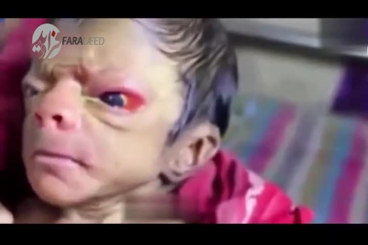 (فیلم) وحشتناک‌ترین نوزاد جهان