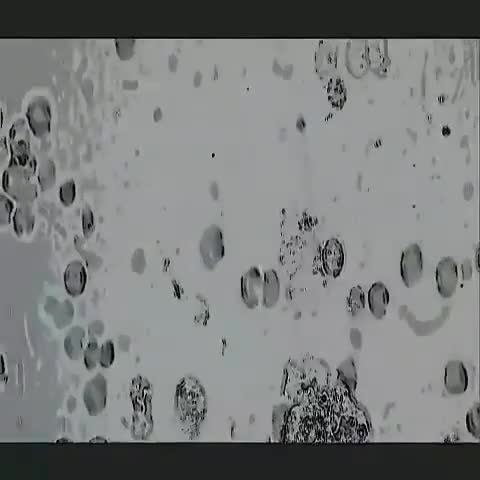 (فیلم) تصاویری از ویروس کرونا زیرِ میکروسکوپ