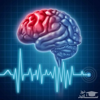 سالانه سه تا شش هزار مرگ مغزی در ایران