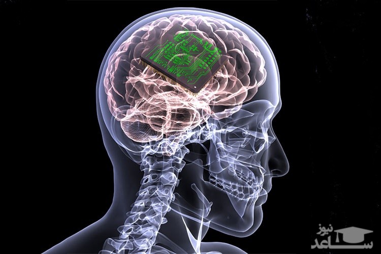 تقویت حافظه انسان با ایمپلنت مغزی
