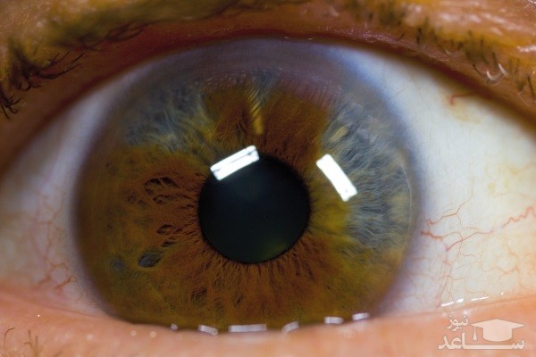 هشدار درباره تغییر شکل اعضای بدن