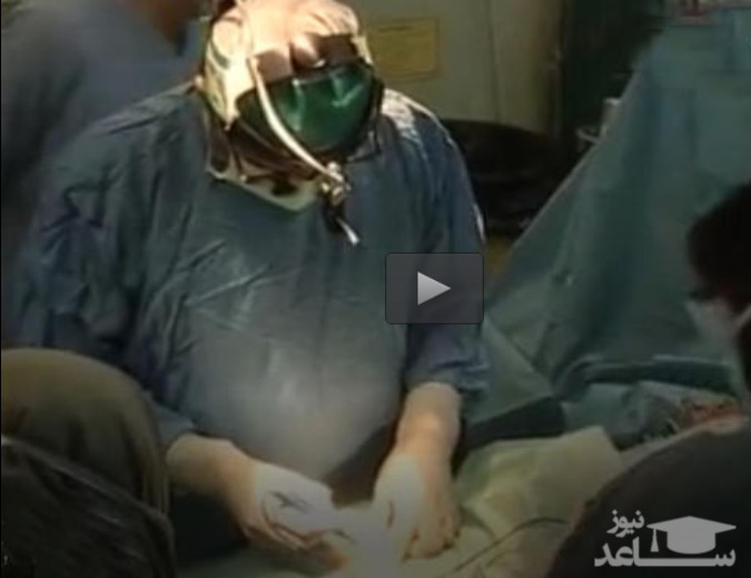 (فیلم) جاماندن"ابزار پزشک"در شکم بیمار!
