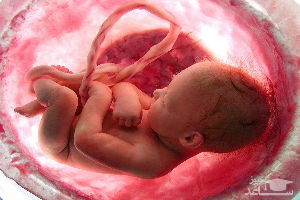 دلایل سقط جنین چیست؟