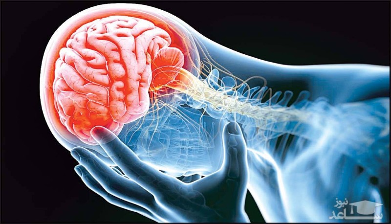 علایمی که نشان میدهد شما سکته مغزی کرده‌اید !