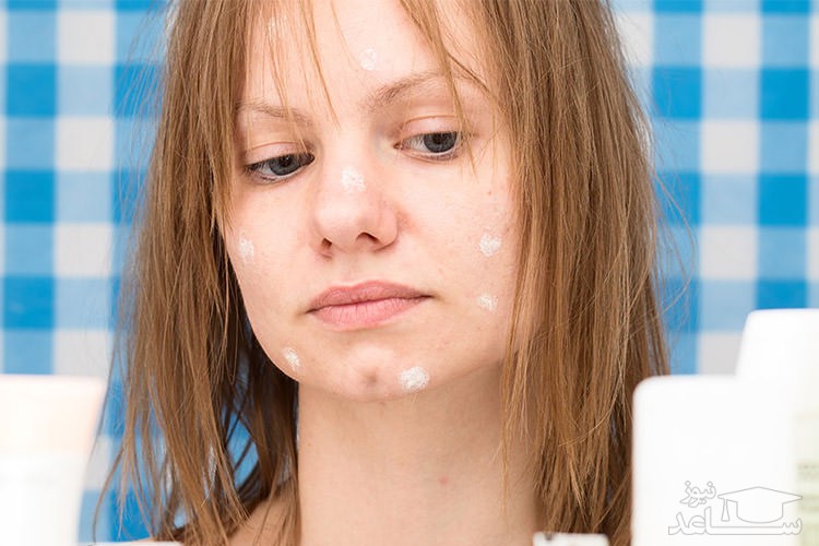 رابطه ویتامین ب12 و آکنه!