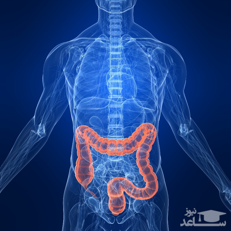 مهمترین دلایل ابتلا به بواسیر یا هموروئید!