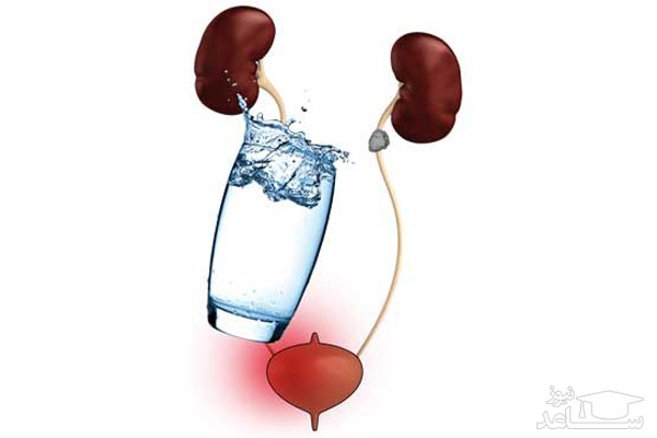 علل و درمان سوزش ادرار در خانم ها و آقایان