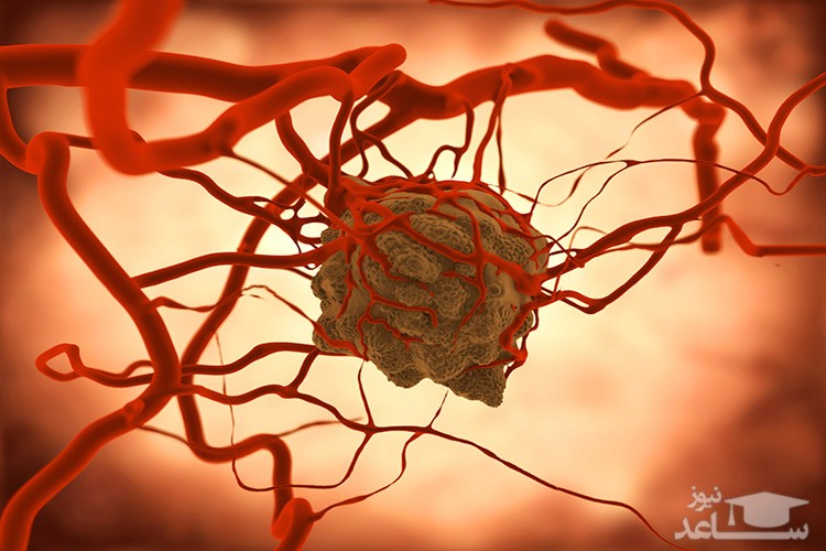 سرطان چگونه موجب مرگ میشود؟