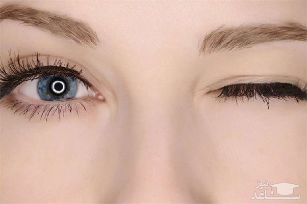 پرش پلک چشم چه زمانی خطرناک است؟