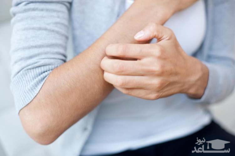 چرا برخی از افراد دچار خارش بدن هستند؟
