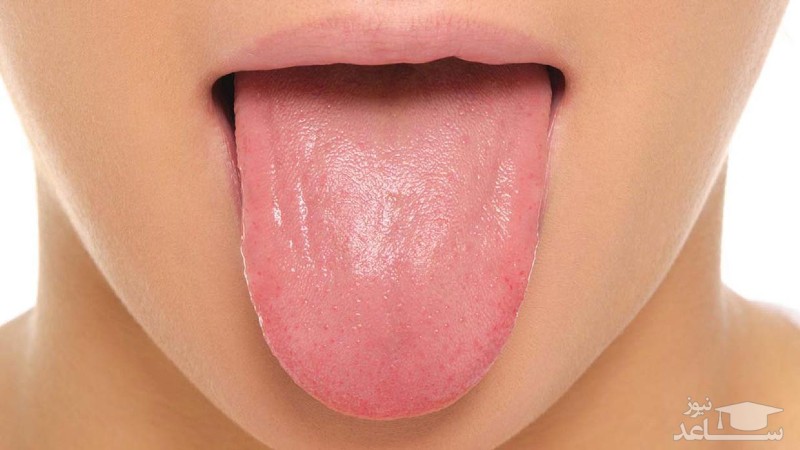 تمیز کردن زبان را فراموش نکنیم