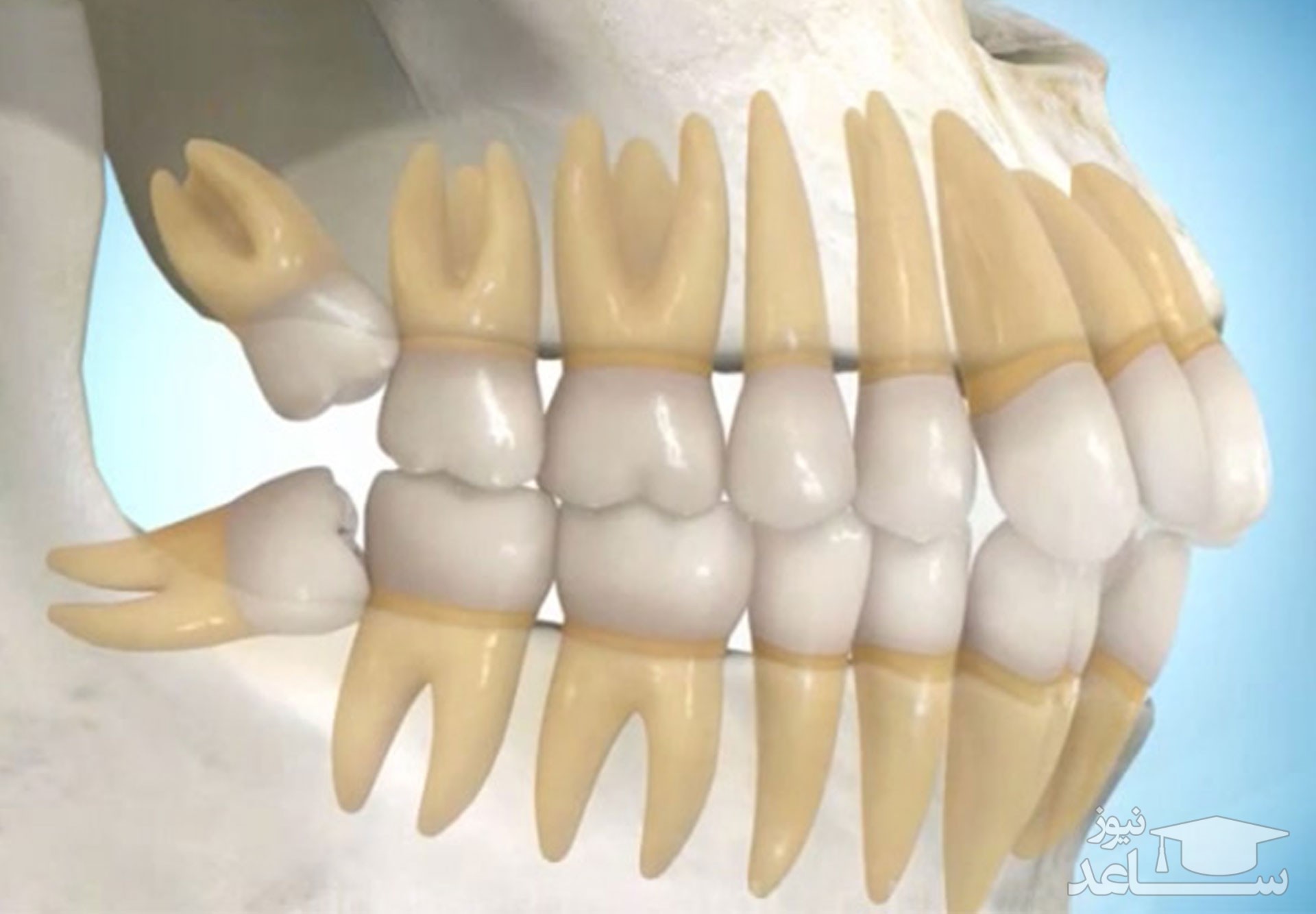 фото задних зубов