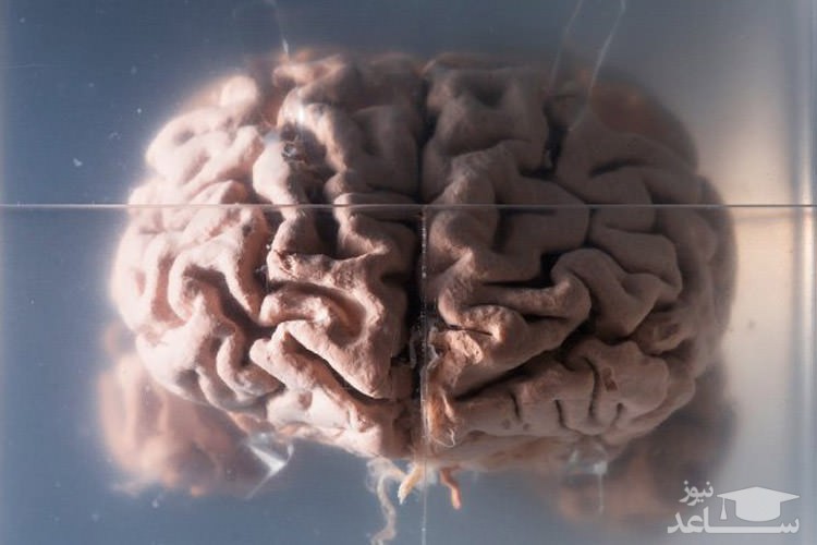 چرا مغز انسان بزرگتر است؟