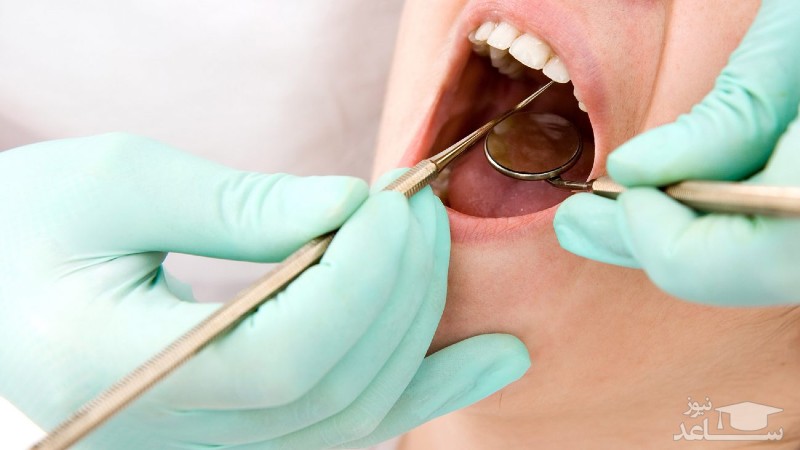 نکروز دندان چیست؟