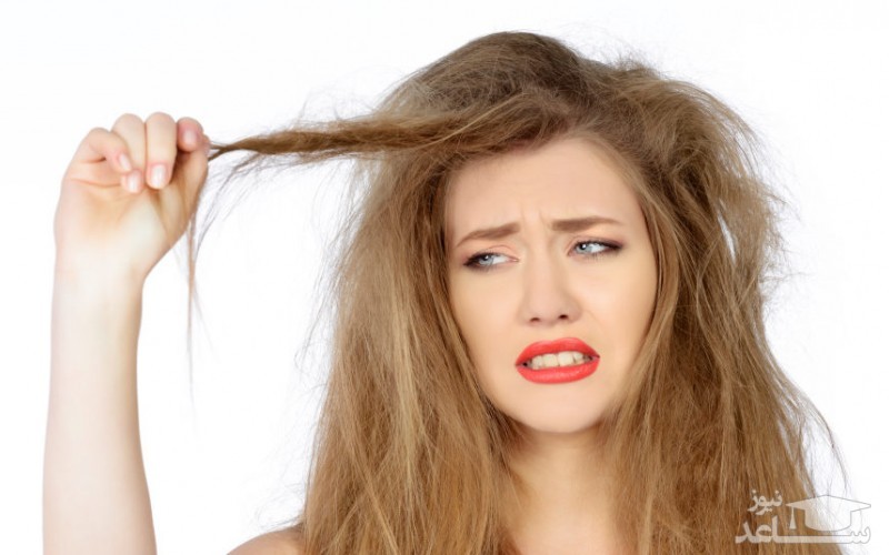 علت چرب شدن موی سر چیست؟