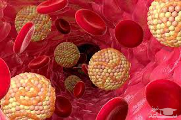 علائمی که به ما میگوید کلسترول خونمان بالاست!