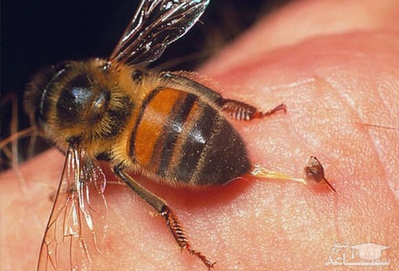 زنبور درمانی ، راهی برای درمان بیماری ها