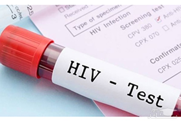 بیماری ایدز چگونه و در کجا تشخیص داده میشود؟