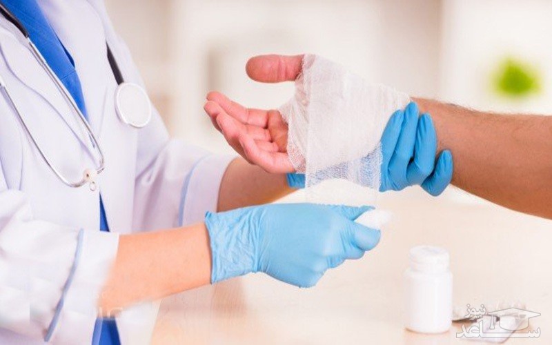 راه های جدیدی برای درمان و تسکین سوختگی در خانه