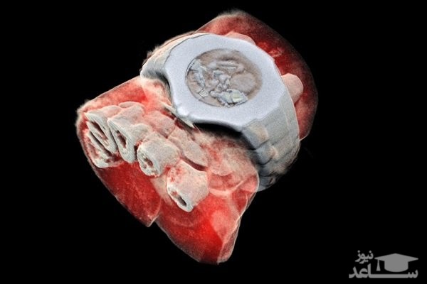 (عکس) اولین عکس سه بعدی رنگی از بدن انسان