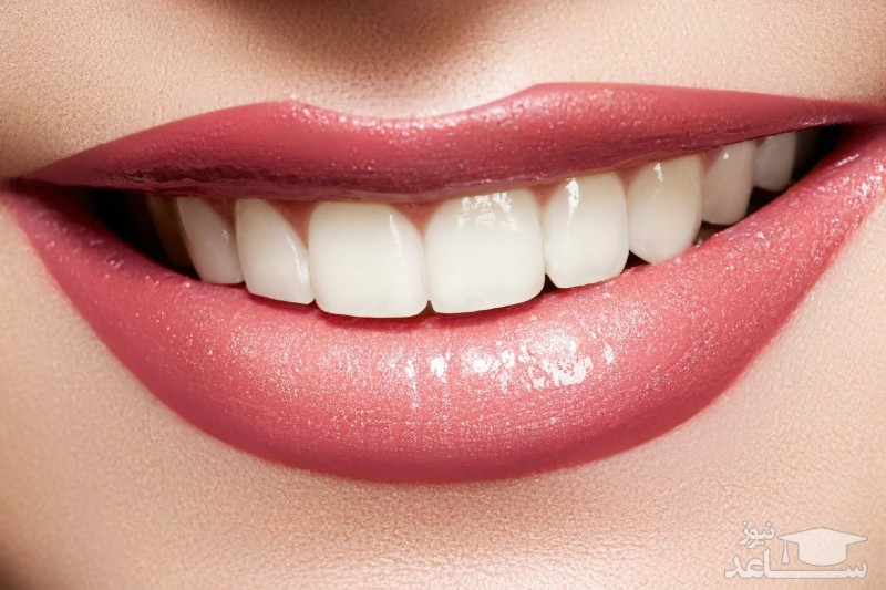 جرم گیری واقعا مینای دندان را ازبین میبرد و مضر است؟