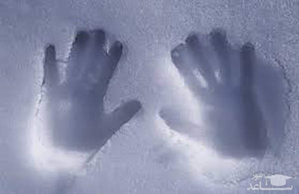 دلایلی که باعث یخ زدن دست ها و پاها میشود؟