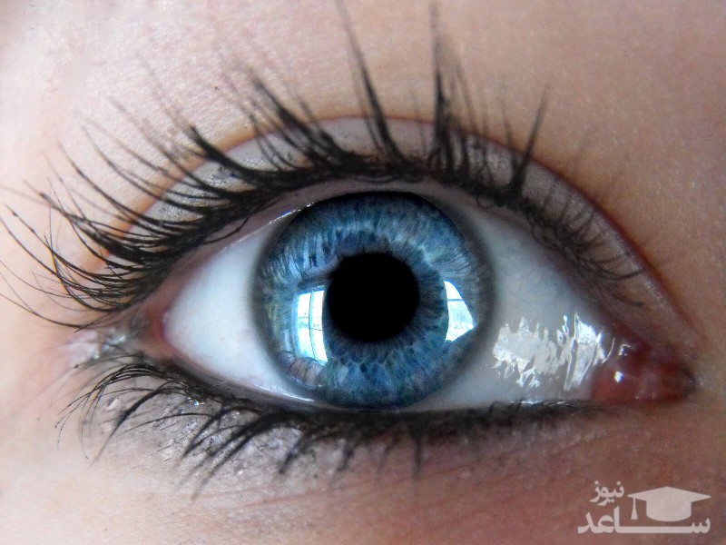 چه عاملی باعث میشود برخی افراد چشمشان دو رنگ داشته باشد؟