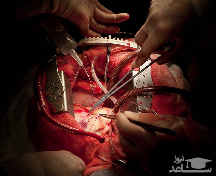 (فیلم) قطع برق بیمارستان حین انجام عمل جراحی