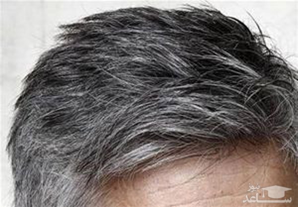 کندن موهای سفید و رنگ کردن مو موجب سفید شدن بیشتر موها میشود؟