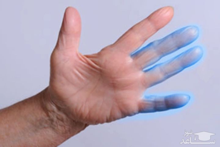 11 بیماری که موجب بی حس شدن دست ها میشود !