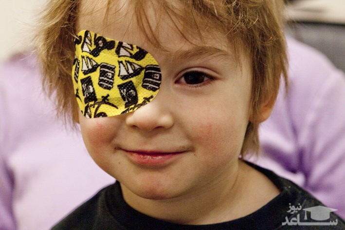 چه عواملی موجب تنبلی چشم کودکان میشود؟
