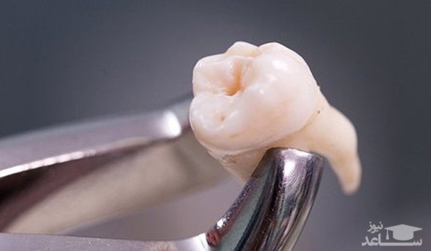 جویدن غذا چه اثری بر روی دندان ها می گذارد؟