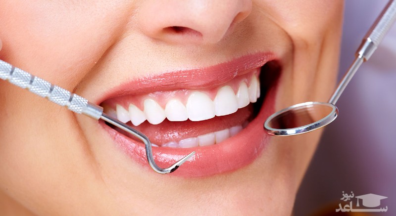 علایم کیست دندانی و درمان آن