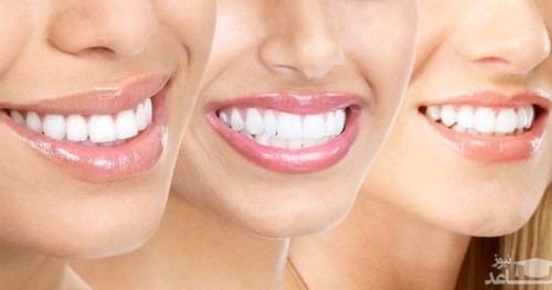 5 راه جادویی برای عفونت دندان