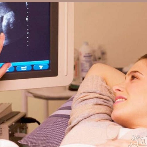 انواع سونوگرافی در دوران بارداری