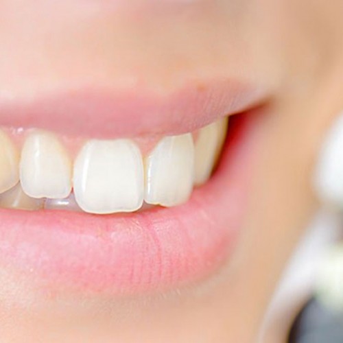 آیا راهی برای پیشگیری از فرسایش مینای دندان وجود دارد؟