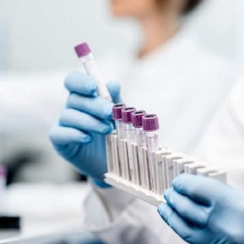 آزمایش واکسن دانشگاه آکسفورد در هند انجام می‌شود