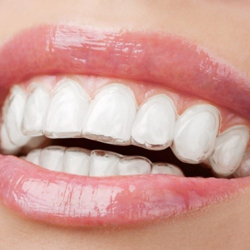 بخش‌های مختلف ساختار دندان چیست؟