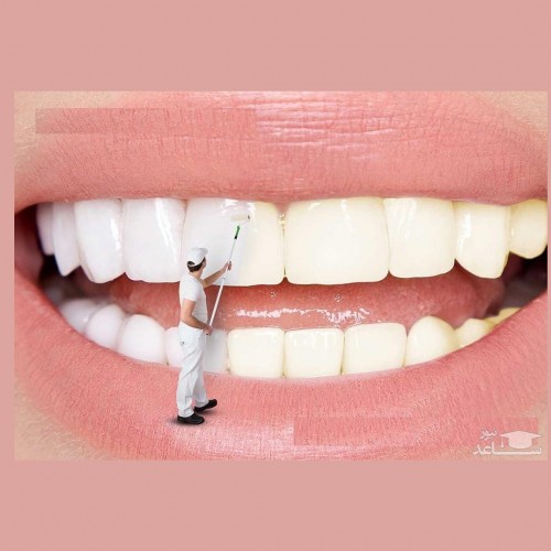 بهترین روش برای سفیدی دندان ها در طب سنتی
