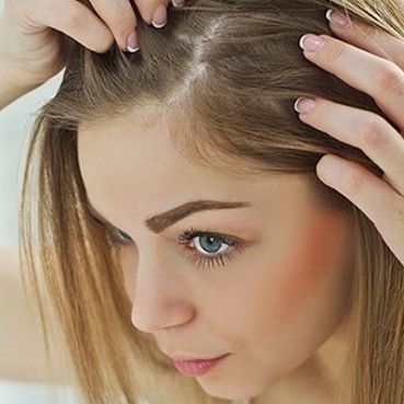 بیماری مروارید مو چیست؟