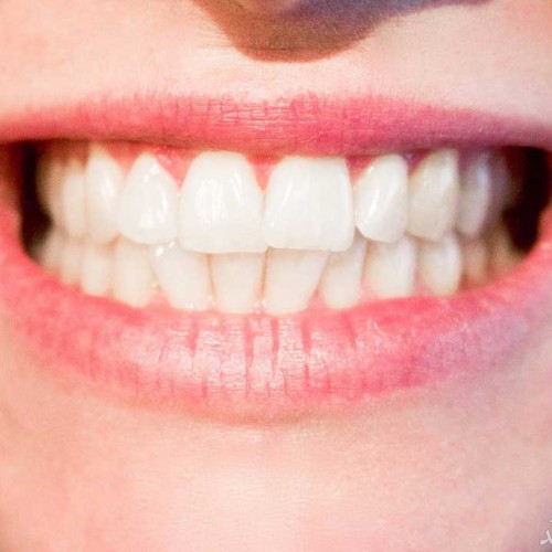 چکاپ دندان ها چه اهمیتی دارد؟