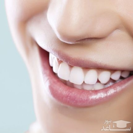 چگونه دندان ها را با روشی کاملا طبیعی و فوری سفید کنیم؟