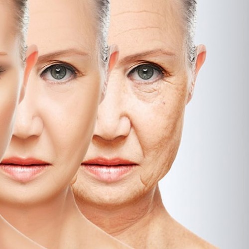 چرا خط خنده بوجود می آید؟