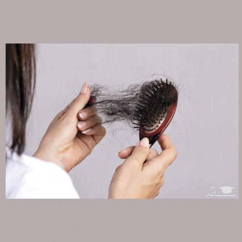 چگونه ریزش طبیعی مو را با از دست دادن مو تشخیص دهیم؟