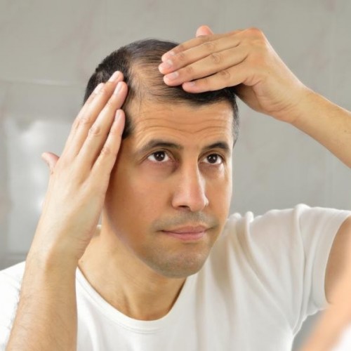 دلیل ریزش مو بعد از کاشت مو چیست؟